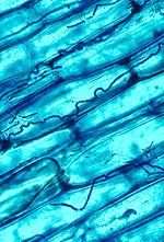 Fungal hyphae, blue-stained, among transparent plant cells.