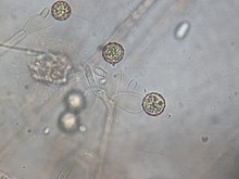 Monoblepharis polymorpha growing on a sesame seed in water collected from a vernal pool near Orono, Maine. Shown are the spiny, brownish resting spores sitting on top the empty oogonia. On the sides of the oogonia are empty antheridia.