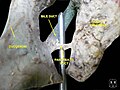 Pancreatic duct Deep dissection.Anterior view.