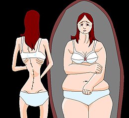 Description de l'image AnorexiaPaint.jpg.