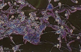 Pythium (Peronosporales)