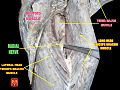 Radial nerve