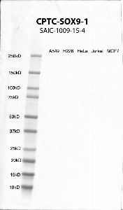 Click to enlarge image Western Blot using CPTC-SOX9-1 as primary antibody against cell lysates A549, H226, HeLa, Jurkat and MCF7. Expected MW of 56.1 KDa. All cell lysates negative.  Molecular weight standards are also included (lane 1).