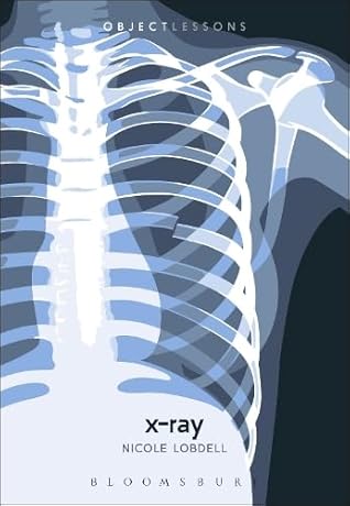 X-ray by Nicole Lobdell