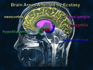 Ecstasy affected the brain.