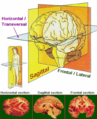 sections of the brain