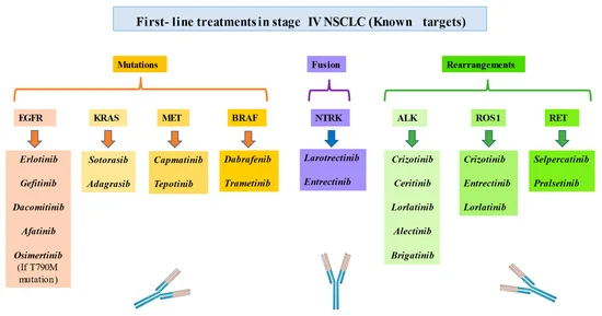 File:Non-small-cell lung cancer.webp