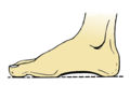 Foot Arche (PSF).png