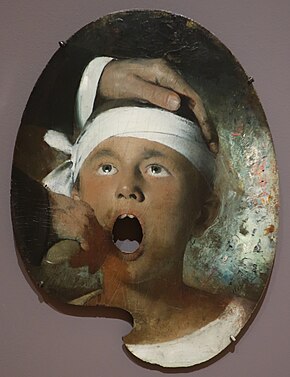 "Boy at the Dentist" by Joseph Decker, unknown date