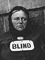 "Blind_Woman,_edit.jpg" by User:Yann