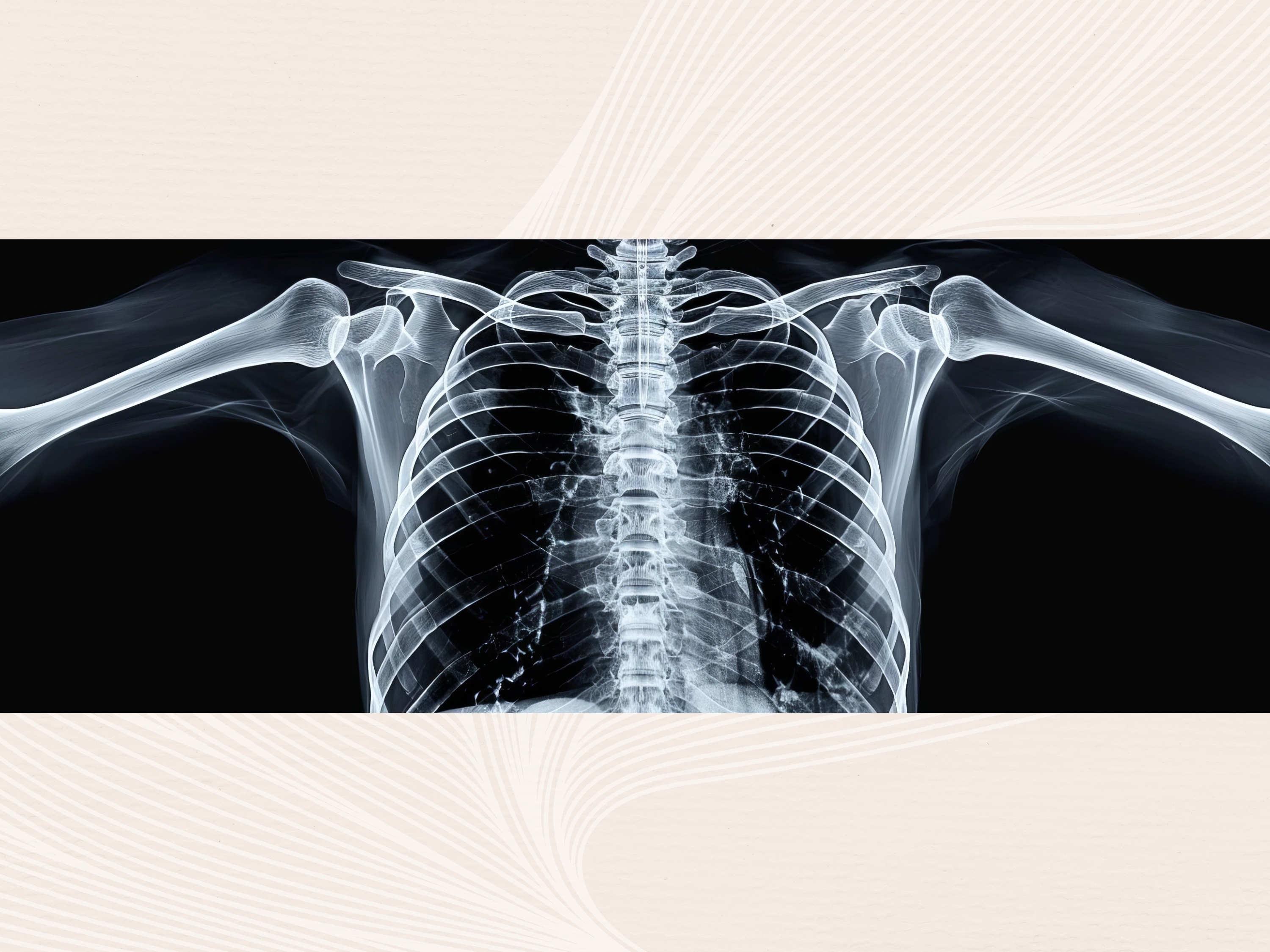 Photo of someone's X-Ray results shows the patient's overall bone quality, not just bone density.