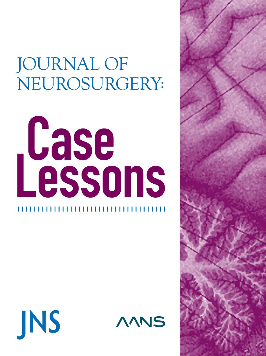 Journal of Neurosurgery: Case Lessons