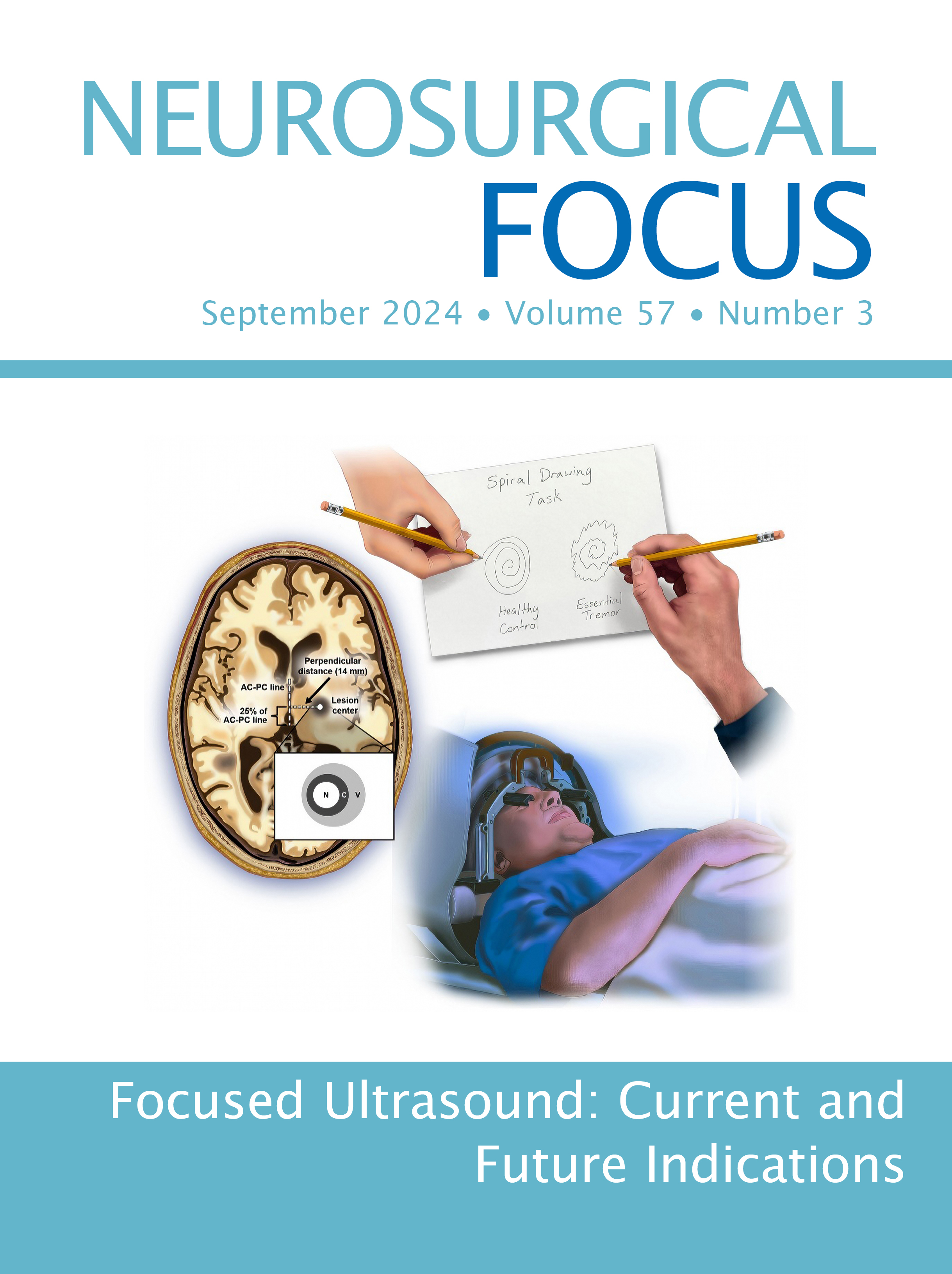 Volume 57: Issue 3 (September 2024): Focused Ultrasound: Current and Future Indications